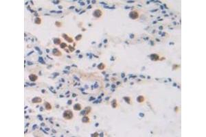 IHC-P analysis of Human Tissue, with DAB staining. (EPAS1 anticorps  (AA 339-541))