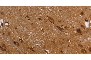 Immunohistochemistry of paraffin-embedded Human brain using FLNA Polyclonal Antibody at dilution of 1:40