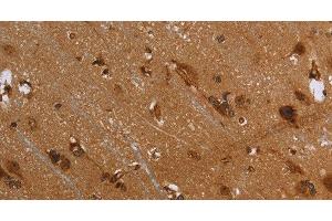 Immunohistochemistry of paraffin-embedded Human brain using FLNA Polyclonal Antibody at dilution of 1:40 (Filamin A anticorps)