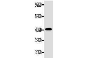Anti-EDA antibody, Western blotting WB: SW620 Cell Lysate