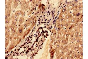Immunohistochemistry analysis of human liver tissue using ABIN7153381 at dilution of 1:100