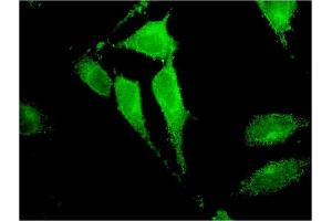 Immunofluorescence of monoclonal antibody to TRIM17 on HeLa cell. (TRIM17 / RNF16 anticorps  (AA 75-184))