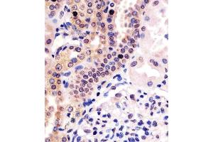 (ABIN6243947 and ABIN6578467) staining PHC3 in human kidney tissue sections by Immunohistochemistry (IHC-P - paraformaldehyde-fixed, paraffin-embedded sections). (PHC3 anticorps  (AA 819-850))