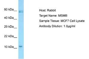 Host: RabbitTarget Name: MSMBAntibody Dilution: 1. (MSMB anticorps  (C-Term))