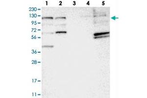 Western blot analysis of Lane 1: RT-4, Lane 2: U-251 MG, Lane 3: Human Plasma, Lane 4: Liver, Lane 5: Tonsil with C10orf118 polyclonal antibody  at 1:250-1:500 dilution. (C10orf118 anticorps)