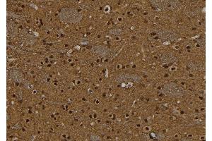 ABIN6277588 at 1/100 staining Rat brain tissue by IHC-P. (BCL11A anticorps  (Internal Region))