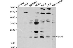 Western Blotting (WB) image for anti-S-Phase Kinase-Associated Protein 1 (SKP1) antibody (ABIN1874792) (SKP1 anticorps)