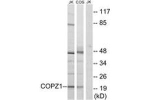 Western Blotting (WB) image for anti-Coatomer Protein Complex, Subunit zeta 1 (COPZ1) (AA 11-60) antibody (ABIN2890228) (COPZ1 anticorps  (AA 11-60))