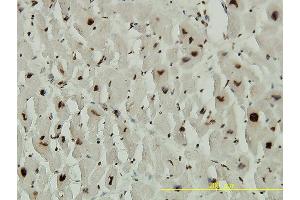 Immunoperoxidase of monoclonal antibody to ACD on formalin-fixed paraffin-embedded human heart tissue.