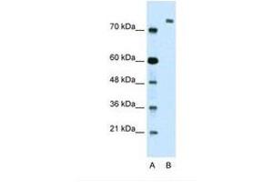 Image no. 1 for anti-Zinc Finger Protein 261 (ZMYM3) (AA 51-100) antibody (ABIN324361) (ZMYM3 anticorps  (AA 51-100))