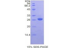 SDS-PAGE of Protein Standard from the Kit (Highly purified E.