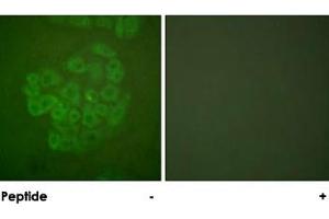 Immunofluorescence analysis of A-549 cells, using NR3C1 polyclonal antibody . (Glucocorticoid Receptor anticorps)