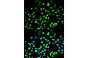 Immunofluorescence analysis of HeLa cells using YWHAQ antibody. (14-3-3 theta anticorps  (AA 1-245))