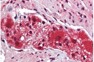 Human Colon, Myenteric Plexus: Formalin-Fixed, Paraffin-Embedded (FFPE)