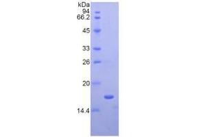 SDS-PAGE of Protein Standard from the Kit (Highly purified E. (APOA1 Kit ELISA)
