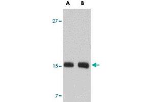 Western blot analysis of SKA2 in NIH/3T3 cell lysate with SKA2 polyclonal antibody  at (A) 0. (FAM33A anticorps  (N-Term))