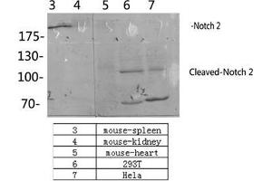Western Blot (WB) analysis: Please contact us for more details. (NOTCH2 anticorps  (Asp1733, cleaved))