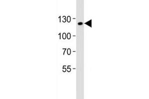 Western blot analysis of lysate from mouse F9 cell line using SIRT1 antibody at 1:1000. (SIRT1 anticorps  (AA 566-601))