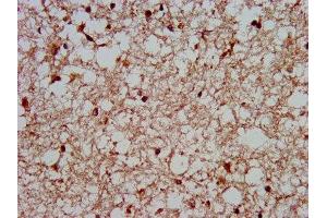 IHC image of ABIN7155794 diluted at 1:400 and staining in paraffin-embedded human brain tissue performed on a Leica BondTM system.