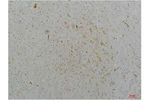 Immunohistochemistry (IHC) analysis of paraffin-embedded Mouse Brain Tissue using Cav2.