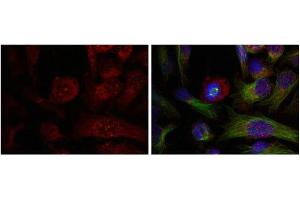 Immunofluorescence staining of methanol-fixed Hela cells showing nuclear dot staining using Akt (Phospho-Thr308) Antibody. (AKT1 anticorps  (pThr308))