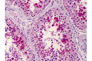 Anti-SLC35D1 antibody IHC of human testis.