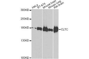 Western blot analysis of extracts of various cell lines, using CLTC antibody. (Clathrin Heavy Chain (CLTC) anticorps)
