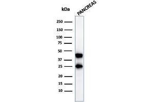 Western Blot Analysis of pancreatic tissue lysate using CPA1 Mouse Monoclonal Antibody (CPA1/2712). (CPA1 anticorps)