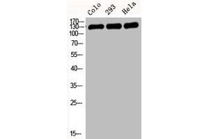 Western Blot analysis of COLO 293T HELA cells using E-cadherin Polyclonal Antibody