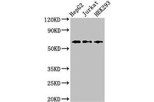 Western Blot Positive WB detected in: HepG2 whole cell lysate, Jurkat whole cell lysate, HEK293 whole cell lysate All lanes: CD96 antibody at 2. (CD96 anticorps  (AA 306-395))