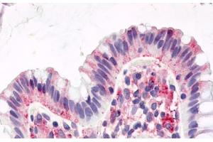 Anti-GPR15 antibody  ABIN1048731 IHC staining of human colon, surface epithelium. (GPR15 anticorps  (Cytoplasmic Domain))