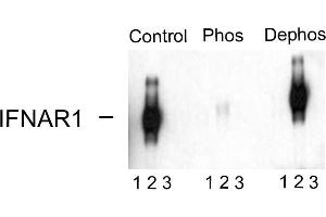 Western blots of immunoprecipitates from HEK 293 cells transfected with 1. (IFNAR1 anticorps  (pSer535, pSer539))