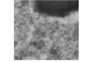 Immunogold labeling of RPE, in vivo injected With mCherry expressing vector; (mCherry anticorps)
