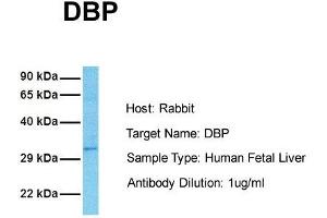 Host: Rabbit Target Name: DBP Sample Tissue: Human Fetal Liver Antibody Dilution: 1. (DBP anticorps  (Middle Region))