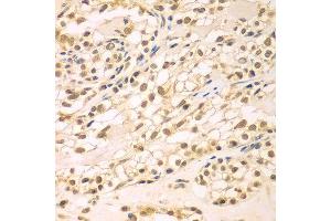 Immunohistochemistry of paraffin-embedded human kidney using TBL1XR1 antibody at dilution of 1:100 (x400 lens).