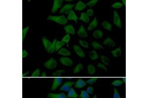 Immunofluorescence analysis of U2OS cells using PLOD2 Polyclonal Antibody (PLOD2 anticorps)
