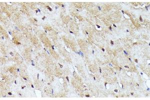 Immunohistochemistry of paraffin-embedded Mouse heart using YAP1 Polyclonal Antibody at dilution of 1:100 (40x lens). (YAP1 anticorps)