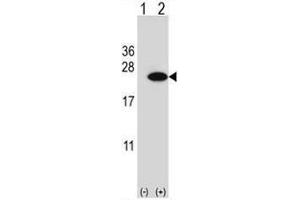 Western blot analysis of CIRBP (arrow) using rabbit polyclonal CIRBP Antibody (C-term) . (CIRBP anticorps  (C-Term))