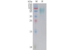 Cynomolgus 5T4 Protein, His Tag on SDS-PAGE under reducing condition.