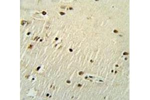 XRCC6 antibody immunohistochemistry analysis in formalin fixed and paraffin embedded human brain tissue.