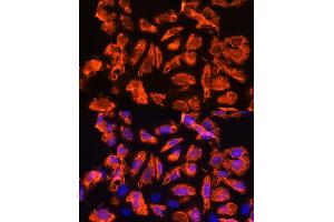 Immunofluorescence analysis of U2OS cells using TCTN1 Rabbit pAb (ABIN7270757) at dilution of 1:100.