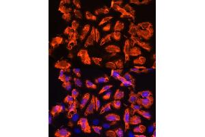 Immunofluorescence analysis of U2OS cells using TCTN1 Rabbit pAb (ABIN7270757) at dilution of 1:100. (TCTN1 anticorps  (AA 130-310))