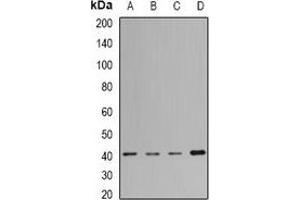 Western blot analysis of MacroH2A1 expression in Jurkat (A), Hela (B), mouse liver (C), rat lung (D) whole cell lysates.