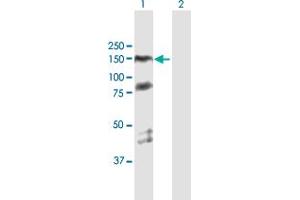 Western Blot analysis of PARP1 expression in transfected 293T cell line by PARP1 MaxPab polyclonal antibody. (PARP1 anticorps  (AA 1-1014))