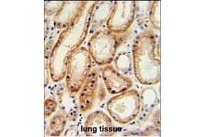 GALNT5 Antibody (N-term) (ABIN653934 and ABIN2843166) IHC analysis in formalin fixed and paraffin embedded human normal lung tissue followed by peroxidase conjugation of the secondary antibody and DAB staining. (GALNT5 anticorps  (N-Term))