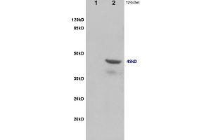 L1 rat brain lysates, L2 rat heart lysates probed with Anti-Tsg101 Polyclonal Antibody, Unconjugated (ABIN685507) at 1:200 in 4 °C.
