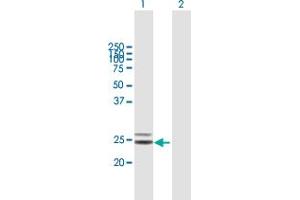 Western Blot analysis of COQ4 expression in transfected 293T cell line by COQ4 MaxPab polyclonal antibody. (COQ4 anticorps  (AA 1-265))