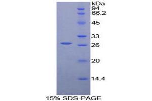 SDS-PAGE analysis of Human LILRA3 Protein. (LILRA3 Protéine)