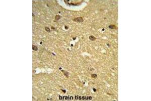 Immunohistochemistry (IHC) image for anti-Ubiquitin Associated Protein 1 (UBAP1) antibody (ABIN3003932)