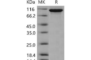 Ectonucleotide Pyrophosphatase / phosphodiesterase 2 (ENPP2) protein (His tag)